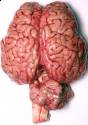 080418-human-brain-02