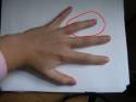 Ringfinger